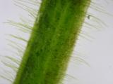 Zelená řasa na listech - pozor na přehnojení, máte